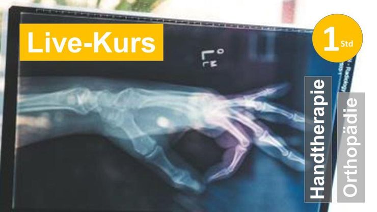 Sie sehen ein Röntgenbild einer Hand  als Assoziation zum Webseminar zum rheumatischen Schmerz im Daumensattelgelenk für Ergotherapie + Physiotherapie in der Rehabilitation von Rheumatologie und Orthopädie in Klinik + Praxis