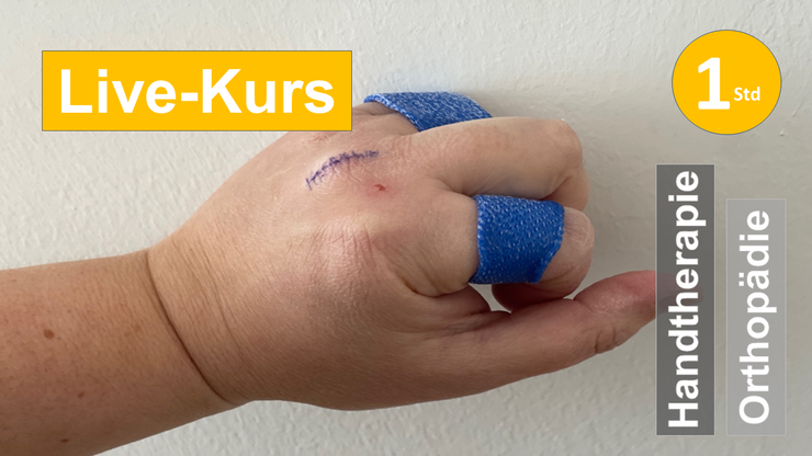 Sie sehen eine Hand mit gebeugten Fingern mit einer Handschiene als Assoziation zum Webseminar über Strecksehnenverletzungen der Finger für Ergotherapie + Physiotherapie in der Rehabilitation Handverletzungen und Handtherapie in Klinik + Praxis